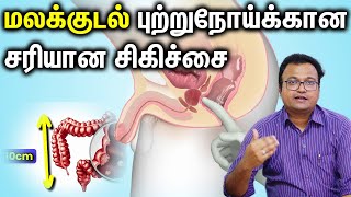 Rectal Cancer மலக்குடல் புற்றுநோய்க்கான சரியான சிகிச்சை Dr Dayananda Srinivasan [upl. by Gavrilla140]