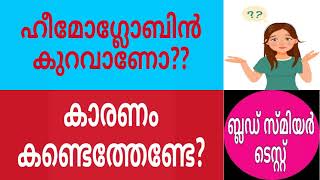 Peripheral Blood Smear  Peripheral Blood Picture Part 1Malayalam [upl. by Mighell]