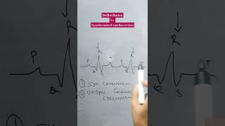 defibrillation vs synchronized cardioversion defibrillationcardioversion [upl. by Pancho]