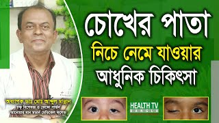 চোখের পাতা নিচে নেমে যাওয়ার আধুনিক চিকিৎসা  Ptosis Treatment  Dr Abdul Mannan  Health Tv Bangla [upl. by Benoite]