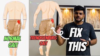 What is Trendelenburg Gait  Causes  Symptoms  Prevention  ​⁠PhysiofitByDrMajid [upl. by Charmaine]