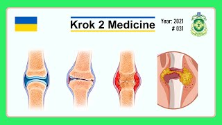 Krok 2 Medicine  Year 2021  031 Ministry of Public Health of Ukraine [upl. by Settle]