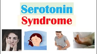 Serotonin Syndrome  Causes Medications Pathophysiology Signs amp Symptoms Diagnosis Treatment [upl. by Ardnusal]