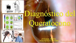 Diagnóstico del Queratocono [upl. by Alyakcim672]