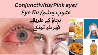 Conjunctivitis Causes symptoms and treatment of conjunctivitis [upl. by Aninotna806]