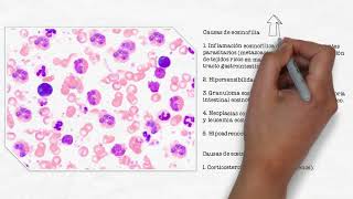 Evaluación del leucograma [upl. by Fia]
