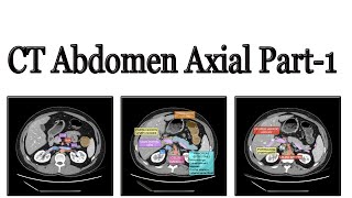 CT Scan of abdomen part 1 [upl. by Nadabus103]