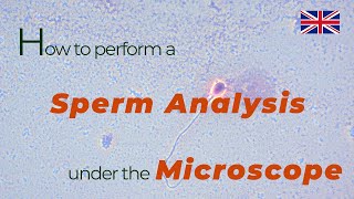 How to perform a sperm analysis under the microscope  urologist göttingen [upl. by Metcalf]