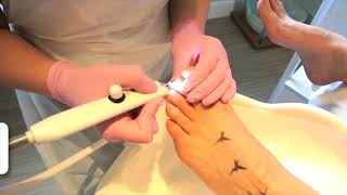 1 Tutorial NAIL MYCOSIS Solution  Imperial Feet Cosmetics [upl. by Scholz809]