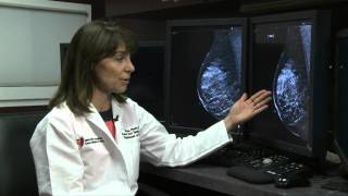 2D vs 3D Mammography [upl. by Claudius]