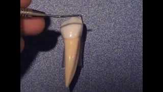 Mandibular 1st Premolar anatomy [upl. by Phillips776]