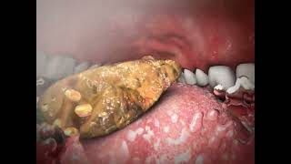 Mechanism of Swallowing Animation in Child model [upl. by Sadnac]