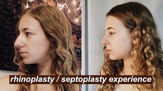 I Got A Nose Job At 16  MY RHINOPLASTY  SEPTOPLASTY EXPERIENCE VLOG [upl. by Annai]