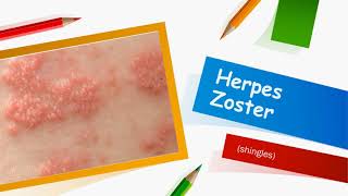 Herpes Zoster [upl. by Bonnie]