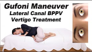 Gufoni Maneuver to Treat BPPV of the Lateral Canal Ageotropic and Geotropic Variations [upl. by Gisela]