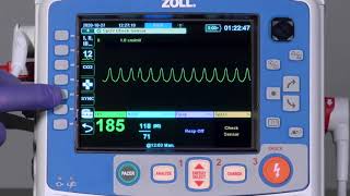 X Series® Advanced Cardioversion English [upl. by Atinav]