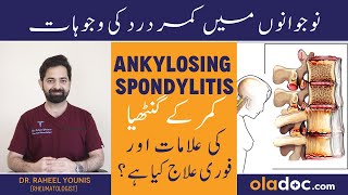 Ankylosing Spondylitis In Urdu  Kamar Dard Ka Fori Ilaj  Ankylosing Spondylitis Symptoms Treatment [upl. by Larrisa]