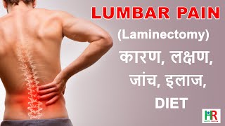 Lumbar Laminectomy in hindi What is lumbar laminectomy prevention after lumbar laminectomy [upl. by Yreneh]