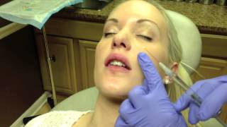 Botox amp Juvederm Lip Injection in Virginia by Dr Naderi DC VA MD [upl. by Ecilahs287]