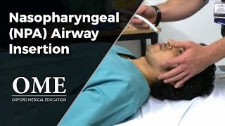 Nasopharyngeal Airway NPA Insertion [upl. by Kelsi]