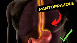 What is Pantoprazole 40 mg used for [upl. by Jaquenette344]