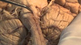 The Most Important Pathway Motor Control Neuroanatomy Video Lab  Brain Dissections [upl. by Nuy413]