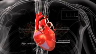 What is atrial fibrillation [upl. by Lorenzo]