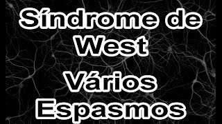 Síndrome de West  Vários espasmos [upl. by Wein400]