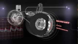 How Brembo Brake System works in F1 [upl. by Odnomyar696]