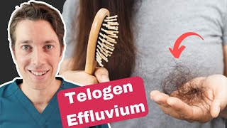 Telogen Effluvium Explained  Best Hair Shedding Treatments [upl. by Nosrettap]