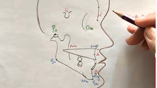 Lateral cephalogram [upl. by Avehsile]