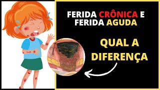 FERIDAS AGUDAS E FERIDAS CRÔNICAS QUAL A DIFERENÇA [upl. by Clarence]