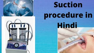 suctioning procedure suction kaise kiya jata h in Hindi [upl. by Marchall239]