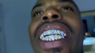 VVS Diamond Grillz In 14KT Yellow Gold amp White Gold [upl. by Clere]