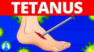 Tetanus Medical Definition  Quick Explainer Video [upl. by Tamberg]