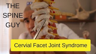 Cervical Facet Joint Syndrome [upl. by Monique]