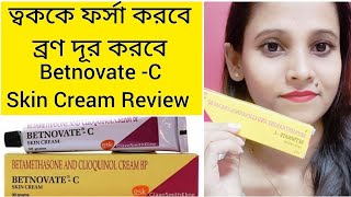 Betnovate c creamBetnovate c cream review in banglaHow to use betnovate c creamUsesside effects [upl. by Hailahk]