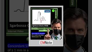 Sgarbossa Criteria of STEMI [upl. by Genesa981]