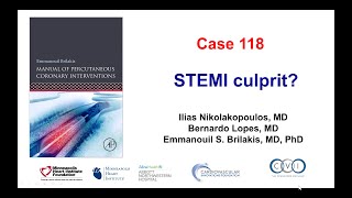 Case 118 PCI Manual  STEMI culprit [upl. by Alten257]