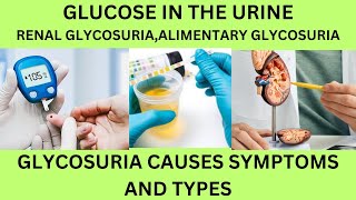 GLUCOSESUGAR IN THE URINE TESTTYPES AND CAUSES OF GLYCOSURIARENALALIMENTERY GLYCOSURIA [upl. by Mendie]