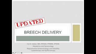 Breech delivery [upl. by Yellas]