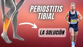 ❌ Descubre Cómo ELIMINAR la PERIOSTITIS TIBIAL FUNCIONA ✅ [upl. by Bollen]