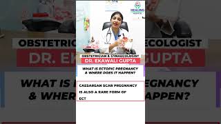 What is Ectopic Pregnancy amp Where does it happen [upl. by Ahsienaj]