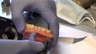 Denture Soft Reline Part 2 [upl. by Thebazile]