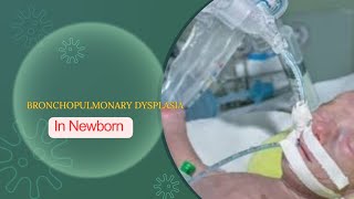 BRONCHOPULMONARY DYSPLASIA CHRONIC LUNG DISEASE  DEFINATION DR MEENA CHOUDHARY [upl. by Nerra]