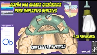 Diseña una guarda quirúrgica para Implantes dentales en exoplan y exocad con Dr Hugo Ochoa [upl. by Etom186]