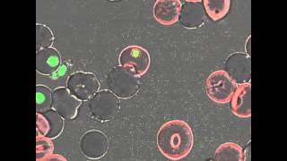 Timelapse video microscopy of the formation and breakdown of the parasitophorous vacuole [upl. by Arbmat917]