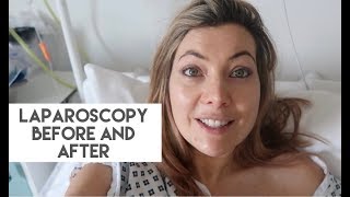 LAPAROSCOPY BEFORE AND AFTER WHY I WAS RUSHED BACK TO HOSPITAL [upl. by Raskind827]