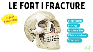 Le Fort I Fracture  Made easy in 5 minutes  Medinare [upl. by Rhpotsirhc]