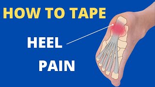 How to tape for heel pain  plantar fasciitis using the Low Dye technique [upl. by Ahsiyt]